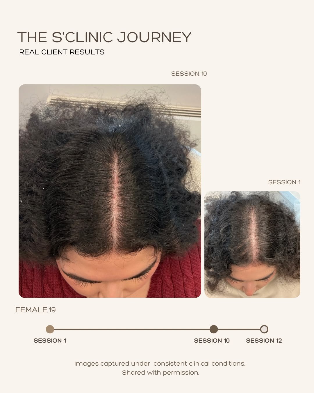 Activation Treatment