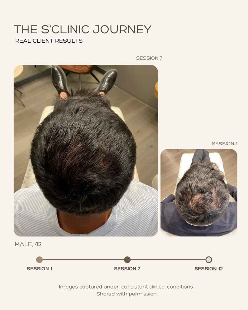 Scalp Analysis